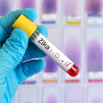 The blood sample positive with Zika virus
