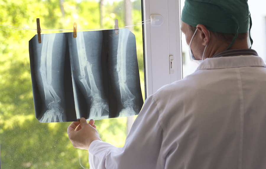x-ray