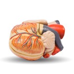 organ-donor