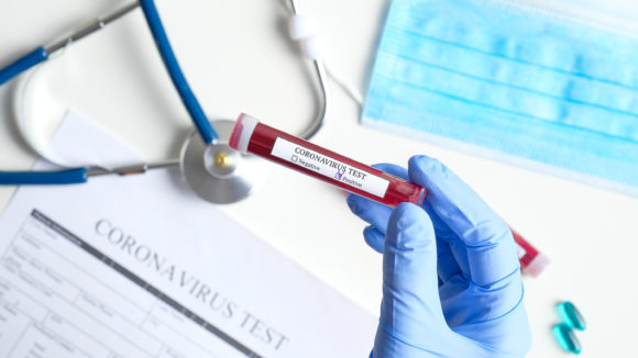 U.S. Probes Batch of Faulty Coronavirus Test Kits