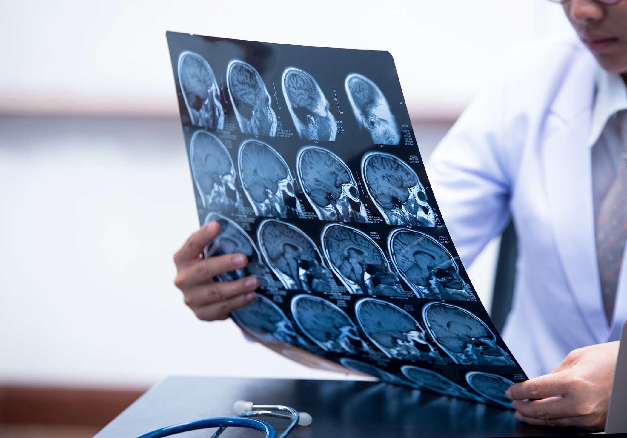 young female doctor holding MRI or CT scan picture, doctor in uniform sitting in working room and holding X-ray picture for diagnosis brain injury or cerebrovascular accident of patient