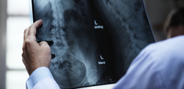 Impact of Medical Fraud Enforcement on California Workers’ Compensation